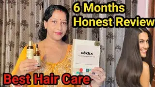 VEDIX Honest Review After 6 Months use | Vedix Hair Products Review Results @SupriyasRannaghor