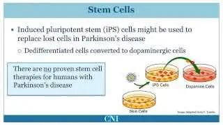 New Research: Disease Modifying Treatment of Parkinson's Disease