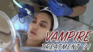 VAMPIRE TREATMENT ?!