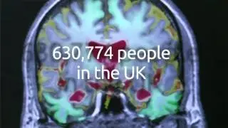 Alzheimer&rsquo;s breakthrough - researchers find chemical which stops death of brain tissue