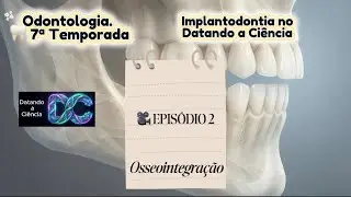 Osseointegração 🎥 EPISÓDIO 2