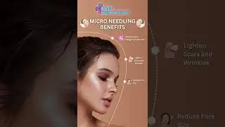 Elevate your Skincare Routine with #MicroNeedling #SmootherSkin #FirmerSkin #SkinHealth #BeautyGoals