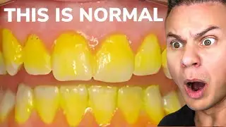 Yellow Teeth Aren&rsquo;t As Bad As You Think