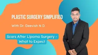 Scars After Lipoma Surgery &ndash; What to Expect