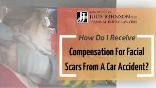 How Do I Receive Compensation For Facial Scars From A Car Accident?