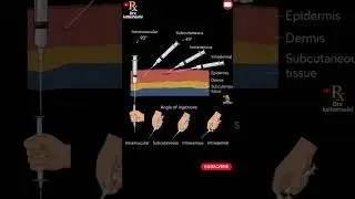 Type of Injection Angles #injection #angles #medical #medicalstudent #nursing #shorts #viral #yt