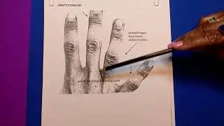 263 SMOOTH OR KNOTTY FINGERS.  WHAT DOES THIS MEAN?