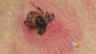 New & Improved Testing Could Make Detecting Lyme Disease Easier