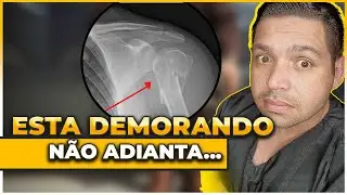 Sua FRATURA está demorando para COLAR?