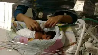 NIDCAP - Implementasi Nesting pada Perawatan Bayi Prematur