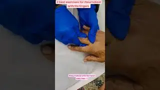 2 best exercises for rheumatoid arthritis fingers to reduce stiffness & pain#shorts #viral