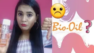 DOES BIO OIL HELP WITH STRETCH MARKS? | BIO OIL HONEST REVIEW | Is It Worth Buying? | Kinnari Ashar