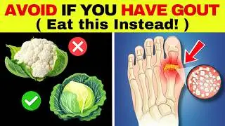 Gout Pain? 5 Vegetables to Avoid Immediately & 5 That Help Relieve It