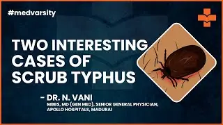 Two Interesting Cases of Scrub Typhus | @MedvarsityTechnologiesPvtLtd