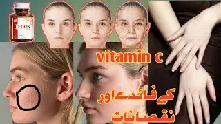 Cecon (vitamin c) tablets benefits uses and side effects in Urdu Hindi