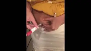Gonal 300 IVF process Day 1