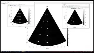 Ultrasound Toolbox &ndash; MATLAB toolbox for processing ultrasonic signals