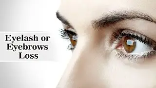 Loss of Eyelash or eyebrows