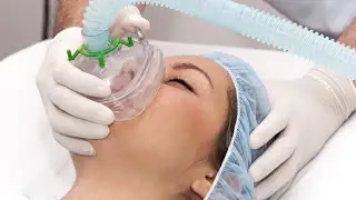 Can Anesthesia Trigger Memory Issues? Exploring the Myths and Facts