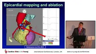 CRY Conference 2017 - ARVC; Overlap with arrhythmia syndromes - Dr Elijah Behr
