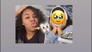 Prepping for Wisdom Tooth Removal (Hair, Errands & Reality