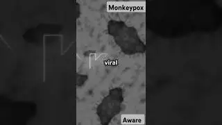 Monkeypox