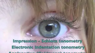 Eye tonometry