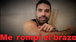 Te cuento la historia de cómo me rompí el brazo y la lección que aprendí!