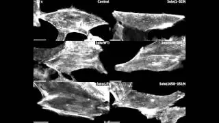 Interplay between Solo and keratin filaments is crucial for mechanical force&ndash;induced stress fiber