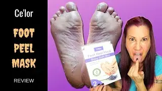 FOOT PEEL MASK REVIEW // Celor Baby Soft Feet Demo, Before and Afters