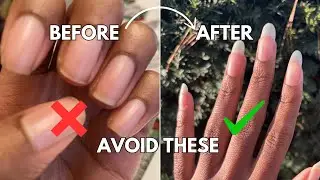 10 COMMON Habits Breaking Your Nails