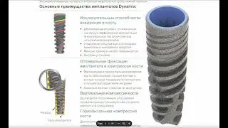 DZirconia.com Каталог CORTEX CONICAL КОРТЕКС КОНИЧЕСКОЕ СОЕДИНЕНИЕ