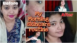 My morning skincare routine | Best results | Priya Sagariya Vlogs