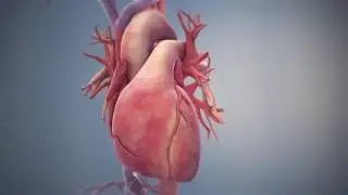 Стент Resolute Onyx (Medtronic) - Анимация