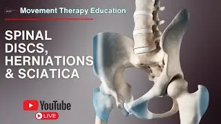 What's REALLY Causing Your Client's Sciatica