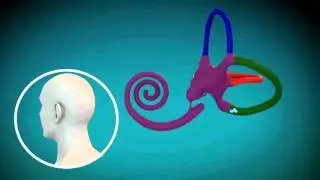 MUSC: BPPV Treatment Series Right Epley Maneuver