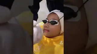 Laser bibir membantu mencerahkan bibir gelap