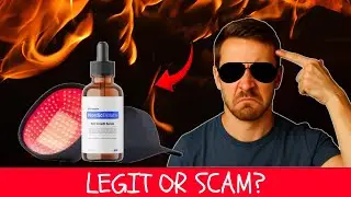 Nordic Biolabs Review 2025: Does This Really Help Hair Grow?