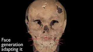 3D Facial Reconstruction