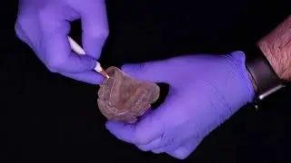 WELCOME TO AMERICAN DENTURIST COLLEGE IMPLANT SUPPORTED REMOVABLE PROSTHETICS COURSE !