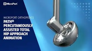 Path® Percutaneously Assisted Total Hip Approach Animation