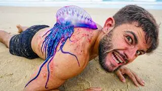 ‼️Меня ужалила ПОРТУГАЛЬСКАЯ КАРАВЕЛЛА‼️ (Спецвыпуск 5M) &ndash; Худшие Укусы #17