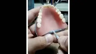 Broken Denture repair in 1 mimute😍 #denture #shorts
