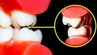 كيف تتوقف عن الجزّ على أسنانك ليلاً وما السبب في خطورة ذلك