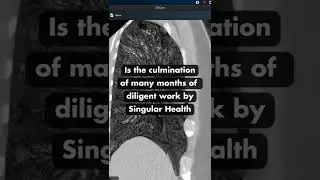 ASX news: Singular Health (ASX:SHG) announces...