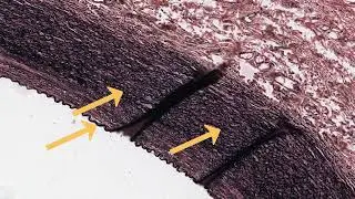 Elastic Tissue