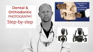 Dental & Orthodontic Photography Tutorial