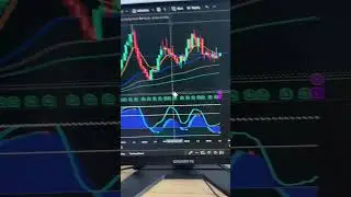 Top Stocks to Watch in July 2025 📈 (Part 1) | Breakouts, Setups & Trade Ideas