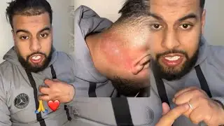 بحرقة بعد خطوبة أسامة تيبو يعلن عن مرضه الخطير 😭 سمعو أشنو واقع ليه 😭
