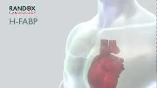 H-FABP | Myocardial Ischemia | Randox Reagents